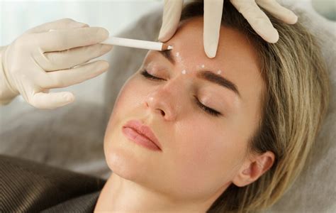 Daxxify vs. Other Neurotoxins