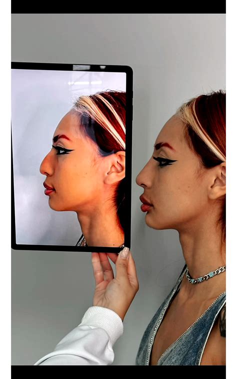 Foto: Ruivinha de Marte antes e depois da harmonização facial: veja a