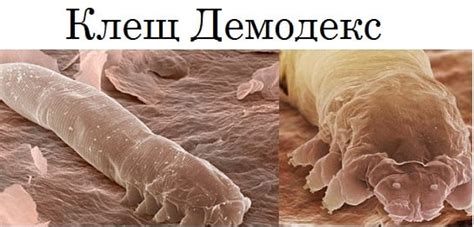 Демодекоз на лице: лечение препаратами и народными средствами