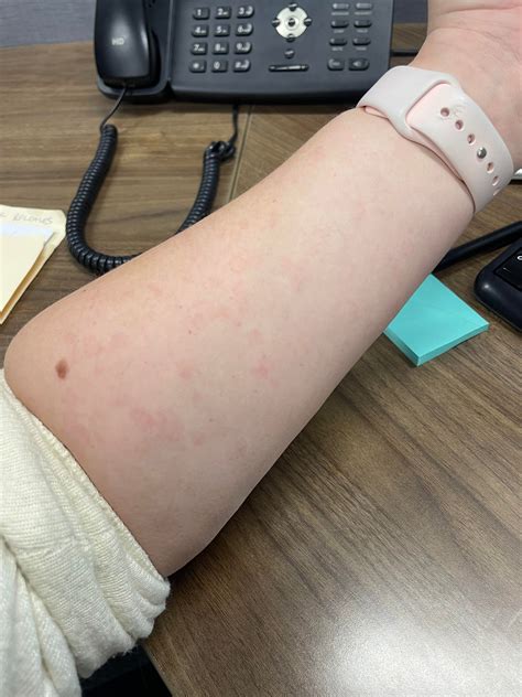 Random rash that comes and goes? : r/skin