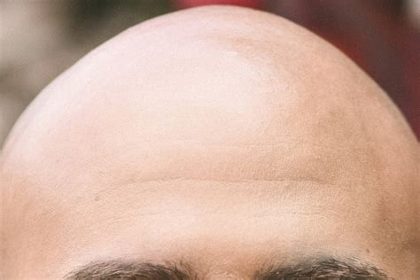 Slack Tide: The good, the bald and the ugly | Juneau Empire