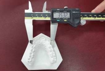 intercanine width measurement  scientific diagram