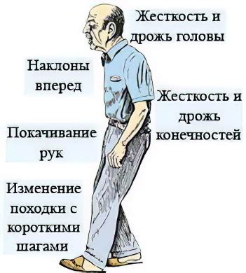 Болезнь Паркинсона – причины, симптомы, стадии, как лечить болезнь ...