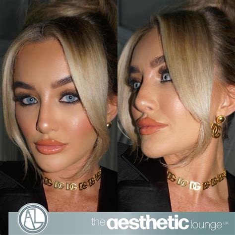 The Aesthetic Lounge UK