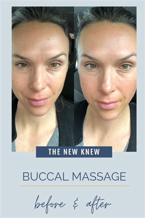 What is Buccal Massage: Ultimate Guide to Facial Rejuvenation - Suite ...