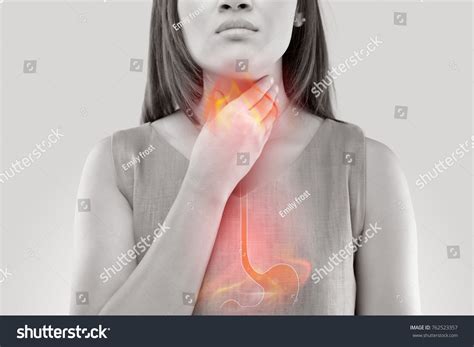 heartburn images stock  vectors shutterstock