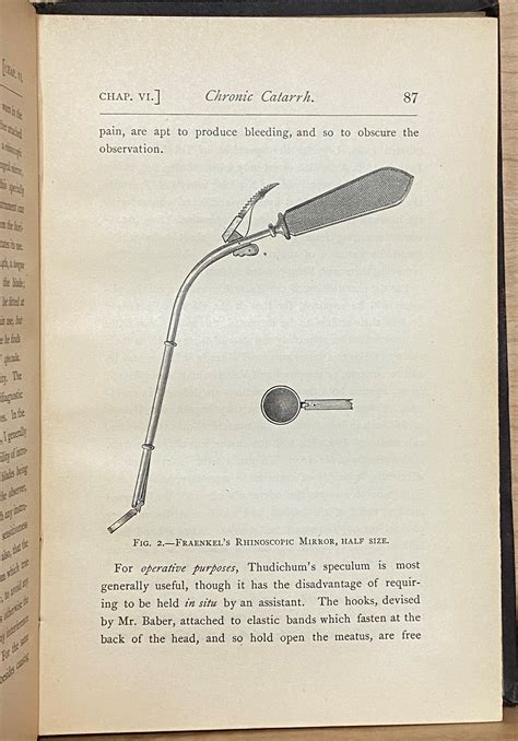 Post-Nasal Catarrh and Diseases of the Nose Causing Deafness 1884