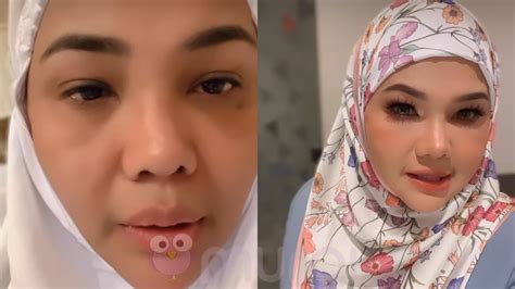 Zarina Zainuddin Sakit Hati Bila Netizen Tanya Pasal Bentuk Hidung ...