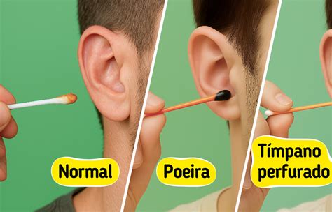 Cera De Ouvido Preta E Dura - 5 Cores de cera de ouvido que podem indicar um problema de saúde oculto