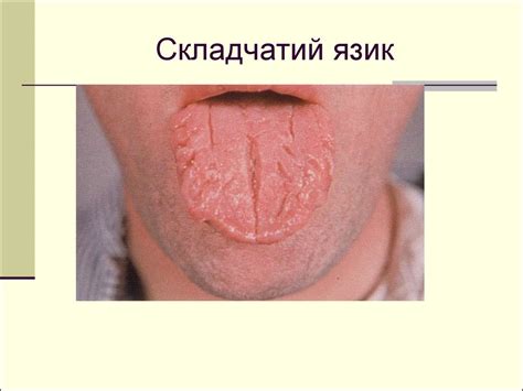 Огляд окремих частин тіла хворого - презентация онлайн