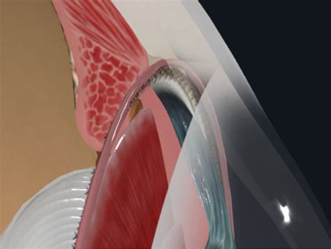 limbus system diagram quizlet