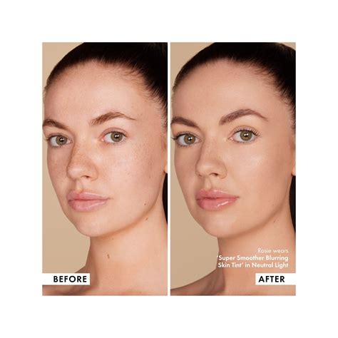 totally smooth skin los angeles 5