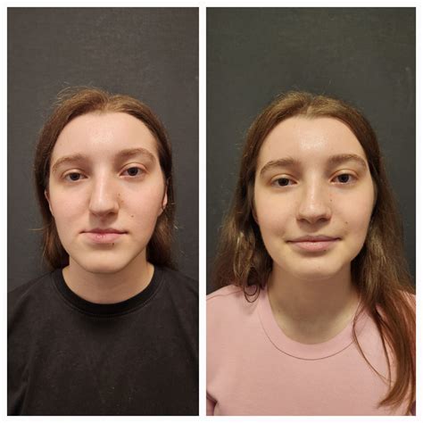 tmj surgery cost without insurance 9