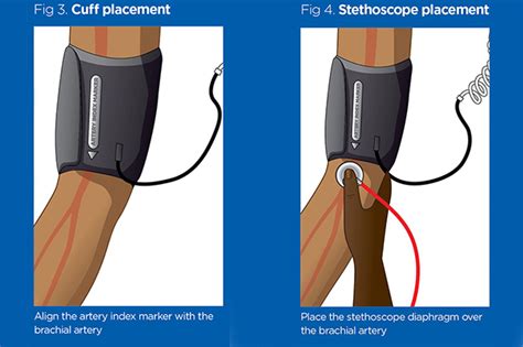 Blood pressure 2: procedures for measuring blood pressure | Nursing Times