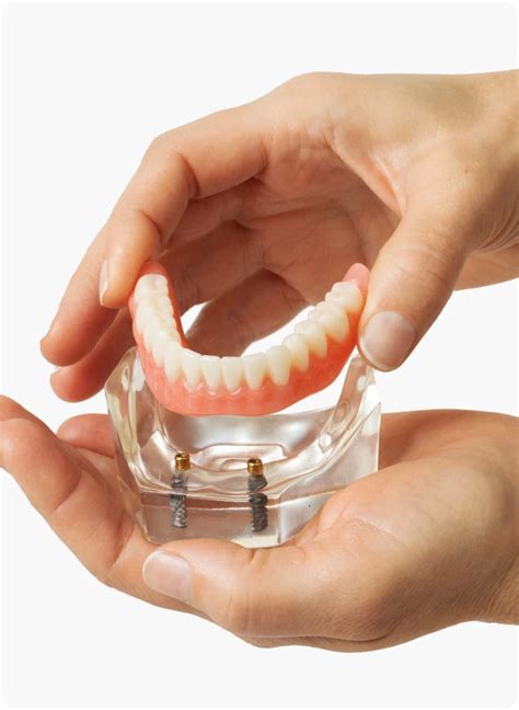 How much do molar dental implants cost? | Aspen Dental