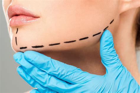 jawline filler istanbul aesthetics hub