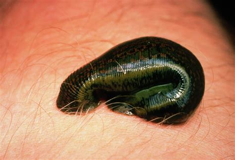 medicinal leech sucking blood  skin  science photo library