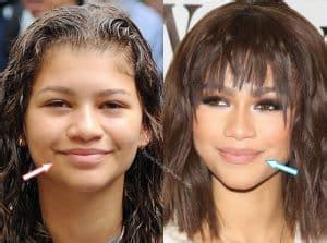 Zendaya: BEFORE and AFTER 2022