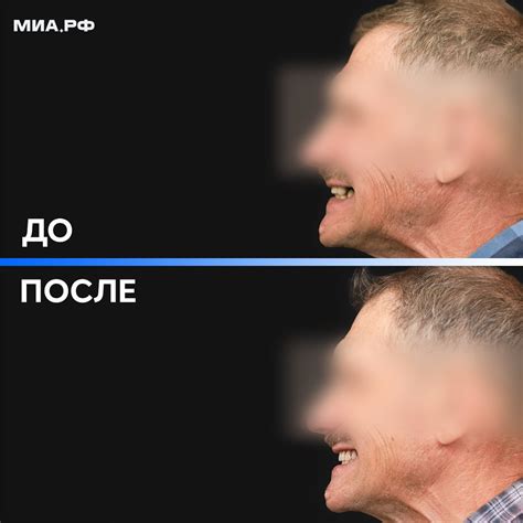 Стоматология МИА.РФ 🦷 МСК и СПБ (@miaclinicstom) • Instagram photos and ...