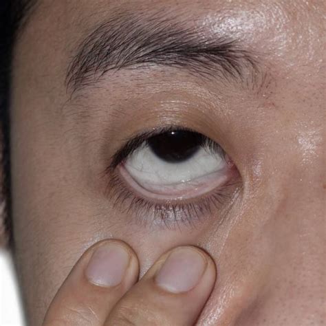 540+ Muka Pucat Foto Foto Stok, Potret, & Gambar Bebas Royalti - iStock