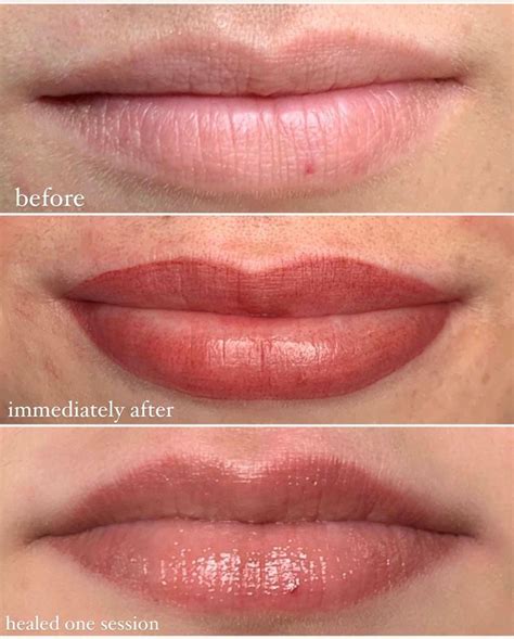 lip liner tattoo before and after - Beau Linville