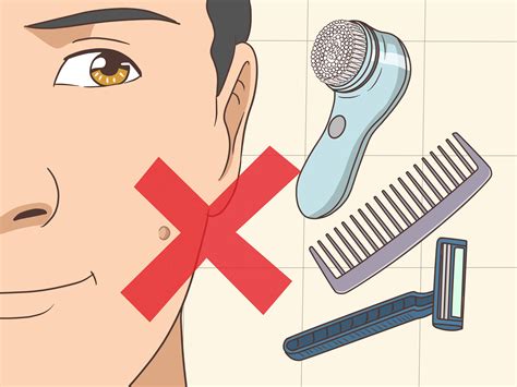 Wart Removal On Face
