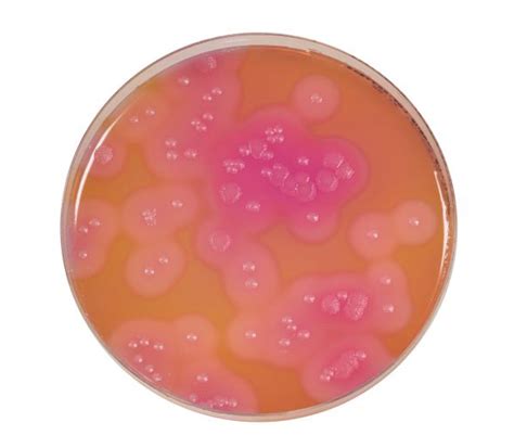 bacillus cereus  acc  mossel biokar diagnostics