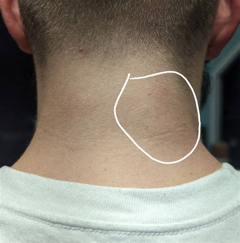 Neck muscle very tight and sticks out. How can I get this part to relax