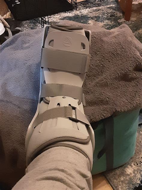 so fun several fractured metatarsal and a hematoma. : r/Dirtbikes