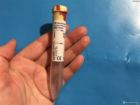 Пробирки для микробиологического анализа BD Vacutainer® BD Vacutainer Z ...