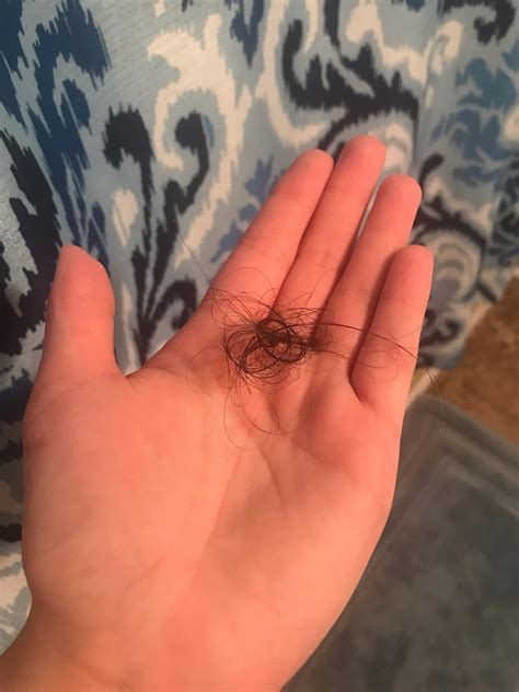 pictures of normal hair loss in shower 13