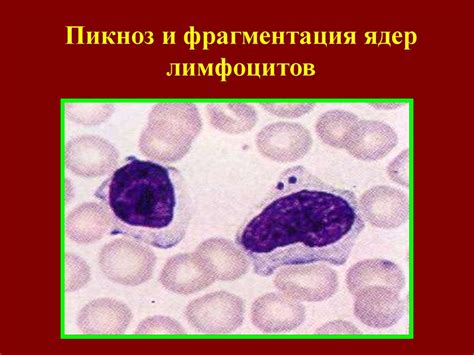 Патологические формы лейкоцитов - презентация онлайн