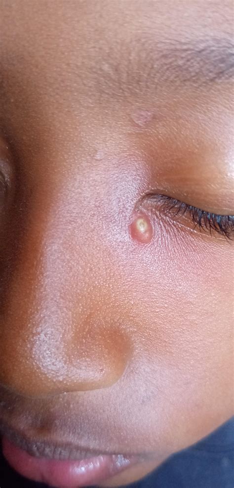 Is This On The Danger Triangle? : r/popping