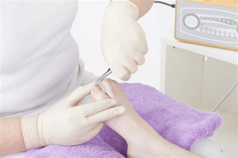 Toenail Treatments & Surgery - Feet in Focus - Podiatry and Chiropody ...