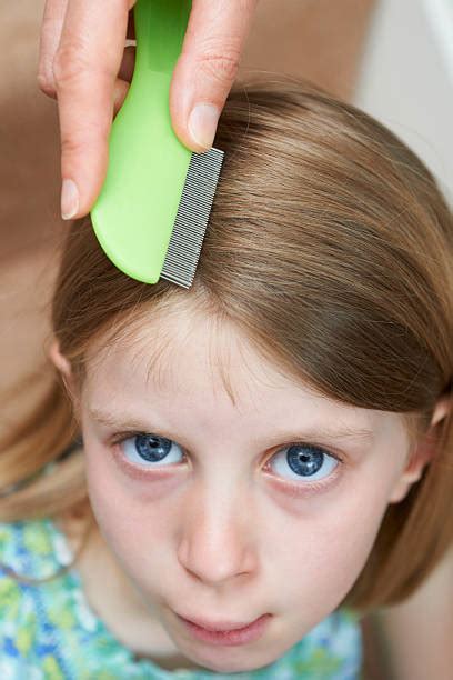 Child Head Lice Stock Photos, Pictures & Royalty-Free Images - iStock