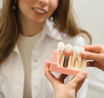 Dental Implants in San Jose, CA [Best Periodontist]