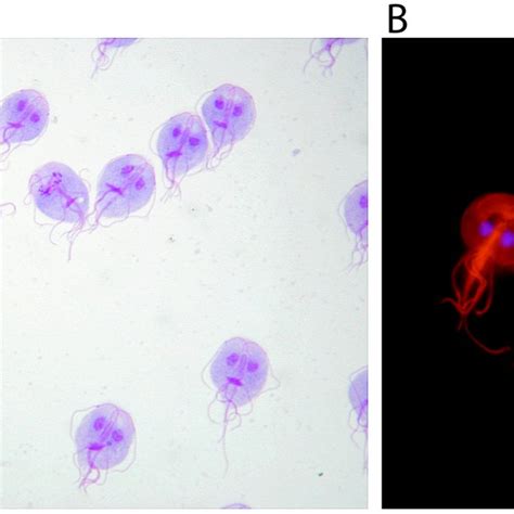 (PDF) Giardia and Vilém Dušan Lambl