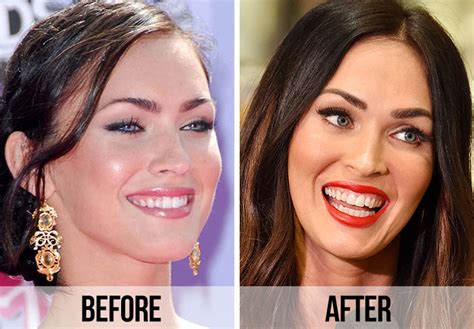 Is forum phun celebrity extra Really That Bad? - evpsjzd