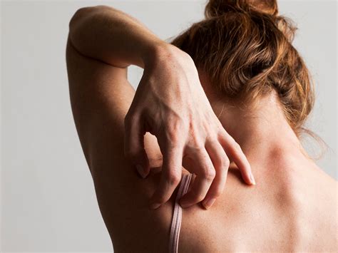 Does Skin Cancer Itch Or Tingle - CancerWalls