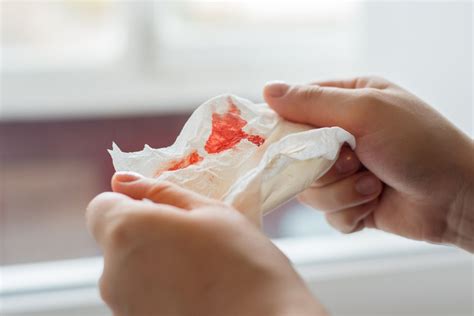 Coughing Up Blood: Symptoms, Causes, and Treatment