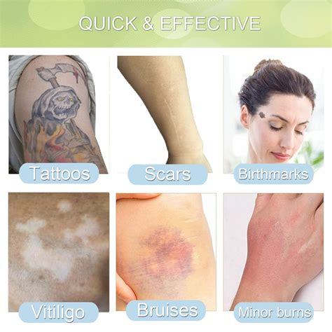 Nude Waterproof Tattoo Cover Up Tape | Scar & Birthmark Concealing