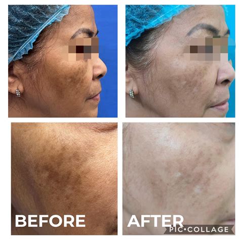 Skin Fairness Dermatology Clinic and Medical Spa | Koronadal