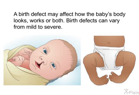 pateducom birth defects