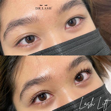 services dr lash dr lash