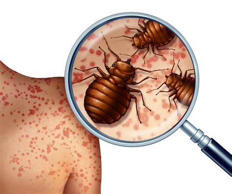 Do You Know the Warning Signs of Bed Bug Infestation? - All N1 Pest ...