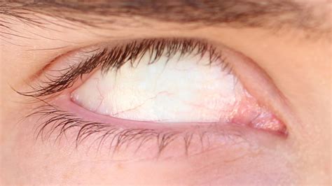 how to make your eyeballs white