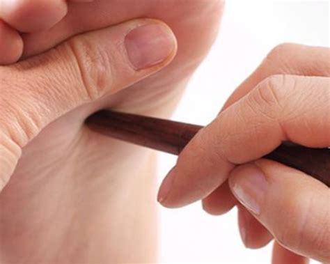 Treatment - Acupressure Health Care Systems
