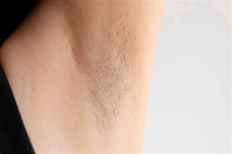 kulit ketiak gelap berikut tips  mengatasinya