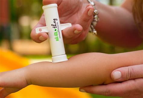 Every Mum Needs This Mozzie Bite Secret Weapon! - Mouths of Mums