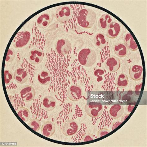pandangan mikroskopis sel darah manusia  corynebacterium difteri
